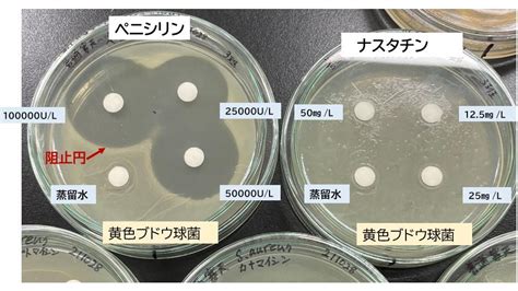 薬剤感受性試験からの『抗菌効果が期待できるおにぎりの具材は？』（東京テクニカルカレッジ バイオテクノロジー科 応用微生物実習1年）〔062