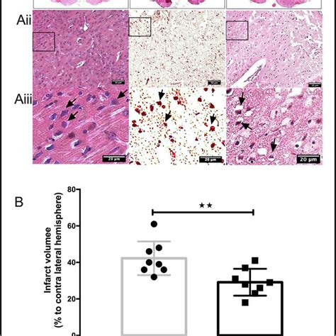 Schematic Representation Of Remote Ischemic Perconditioning RIPerC