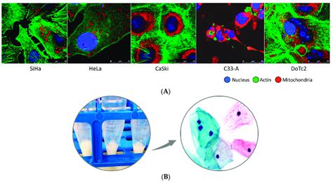 Representative Images Of Cervical Carcinoma Cell Lines And Cervical