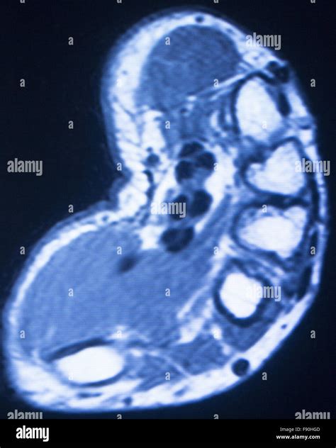 MRT Magnet Resonanz Tomographie Medizinische Scan Testergebnisse Von