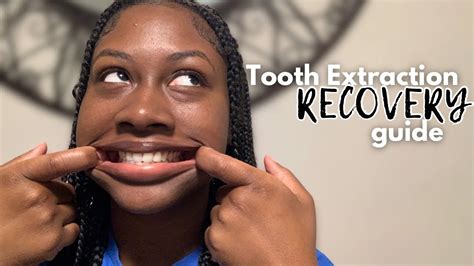 Tooth Extraction Wisdom Tooth Removal Healing Process After Care