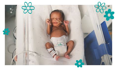 Premature Meaning Premature Babies: MedlinePlus 