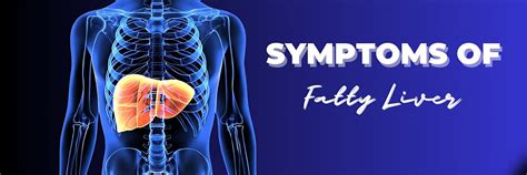 Ayurvedic Symptoms of Fatty Liver