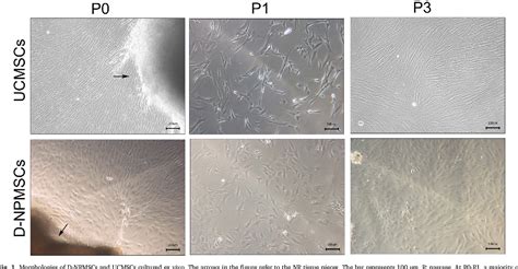 Figure 1 From Comparison Of Nucleus Pulposus Stemprogenitor Cells Isolated From Degenerated