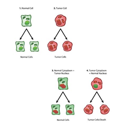 Cancer as a Metabolic Disease — Dietary Therapies