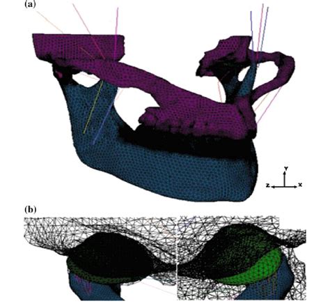 The Mesh Of Finite Element Model A Global View B Details Of Left And Download Scientific