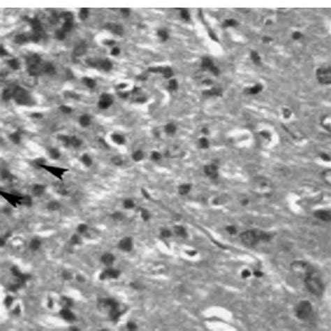 Micrograph Of Cerebral Cortex Of Control Rats Showing Normal Download Scientific Diagram