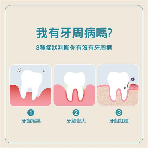 牙周病治療常見問題，解析牙周病症狀及水雷射牙周病治療新選擇