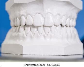 Dental Impression Images, Stock Photos & Vectors | Shutterstock