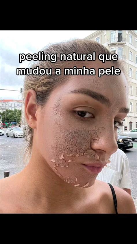 Peeling Natural Que Mudou A Minha Pele Em 2024 Tratamentos Faciais