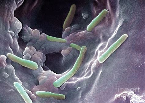 Pseudomonas Aeruginosa Photograph by Science Source