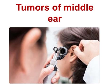 Tumors Of Middle Ear Pptx