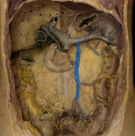 Anatomy Physiology II Lab Veins Associated With The Hepatic Portal