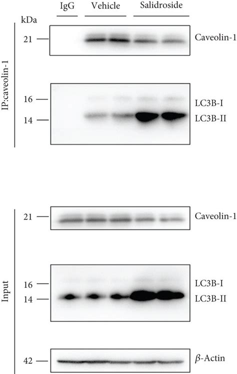 Salidroside Increases The Interaction Between P Src C Cbl And Lc B