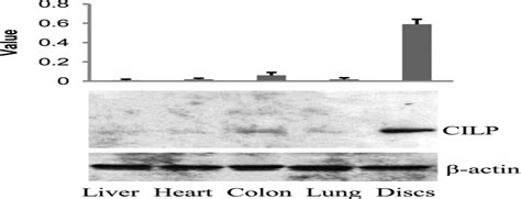 Cartilage Intermediate Layer Protein Cilp Regulation In In Spine