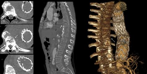 The vertebrae X-ray images | Kaggle