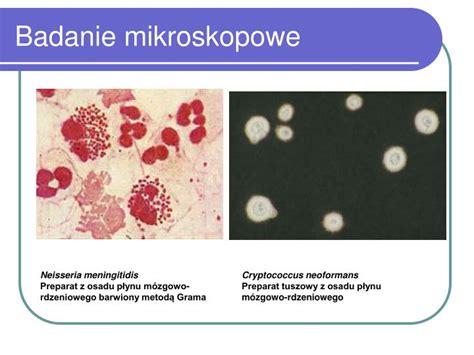 Ppt Metody Detekcji I Identyfikacji Bakterii Powerpoint Presentation