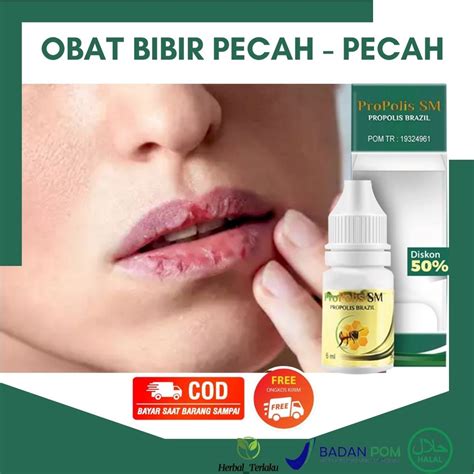 Jual Obat Oles Bibir Pecah Pecah Mengelupas Kering Berdarah