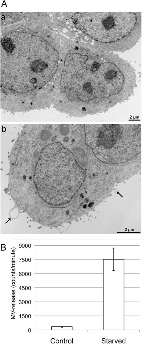 Figure 1 From Tumor And Endothelial Cell Derived Microvesicles Carry