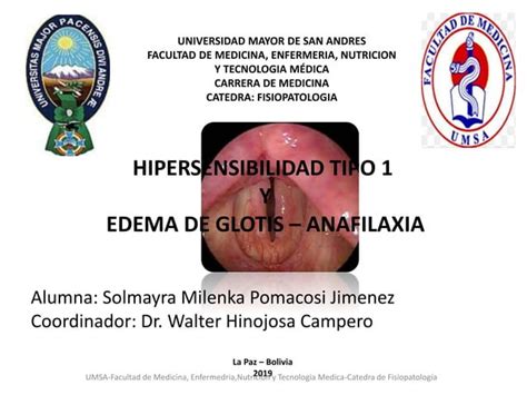 Hipersensibilidad Tipo 1 Y Edema De Glotis Anafilaxia Ppt