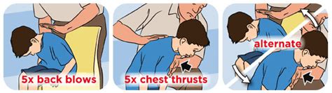 Choking First Aid Treatment — Far North Training And Consultancy