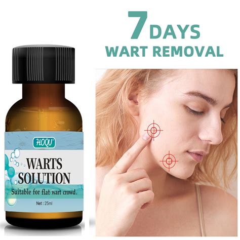 Warts Remover Original Painless Kulugo Remover Solution Skin Tags Mole