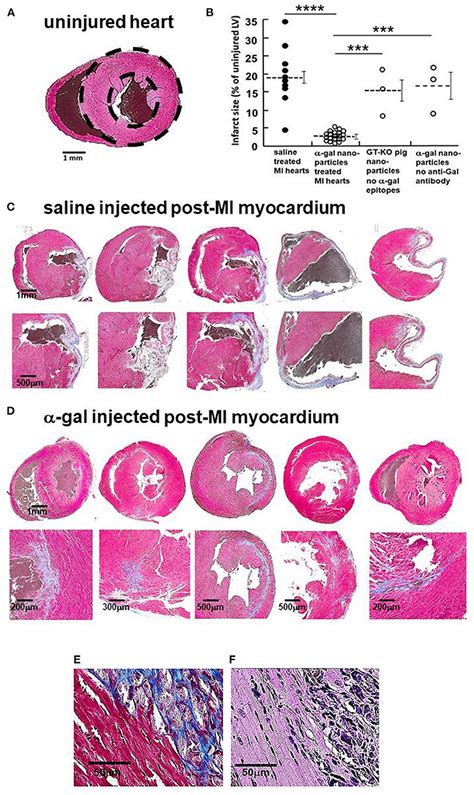 Frontiers Near Complete Repair After Myocardial Infarction In Adult