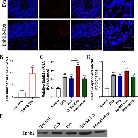 Ephb Ephrin B Axis Promotes The Homing Of Evs To Inflammatory Colon