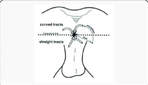 b: Goodsall's rule (in prone position). | Download Scientific Diagram