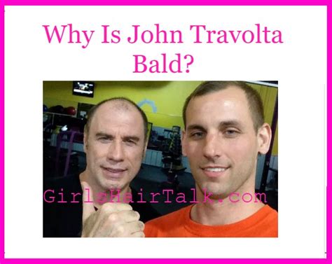 Why Is John Travolta Bald? Find Out The Truth!