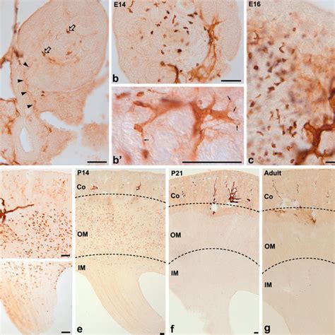 Light Micrographs Of 50 μm Vibratome Sections Illustrating