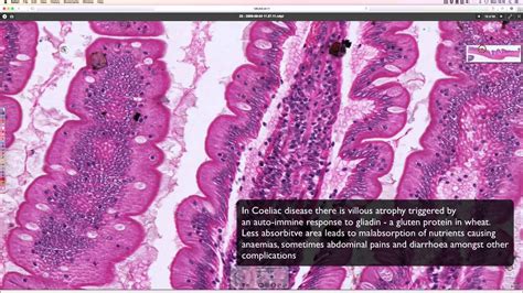 Normal Duodenum Histology