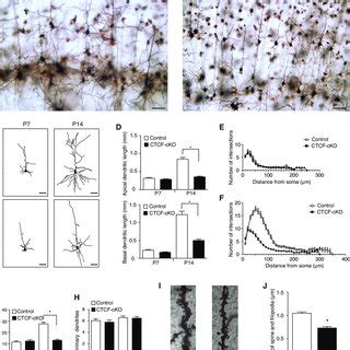 Decrease In Dendritic Arborization And Spine Number In The Cortical