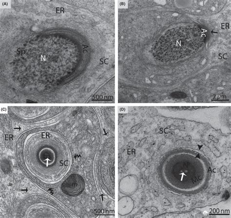 Electron Micrograph Of A Sertoli Cell During Spermiogenesis In October