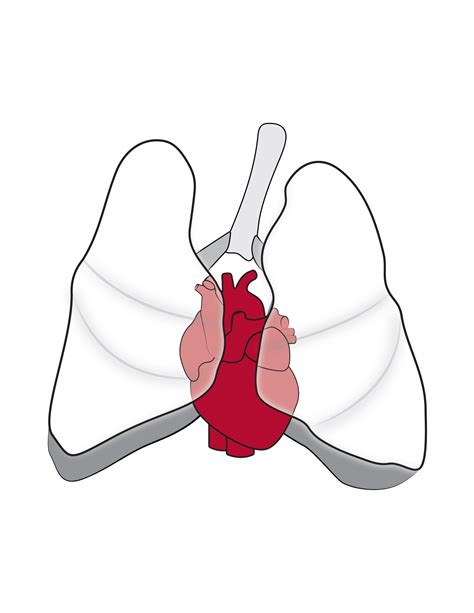 Pediatric Cardiothoracic Surgery Department Of Surgery Washington