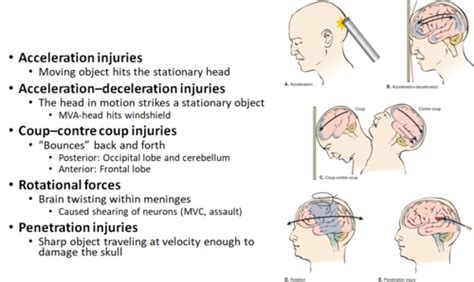 Ch 36 Traumatic Brain Injury Flashcards Quizlet