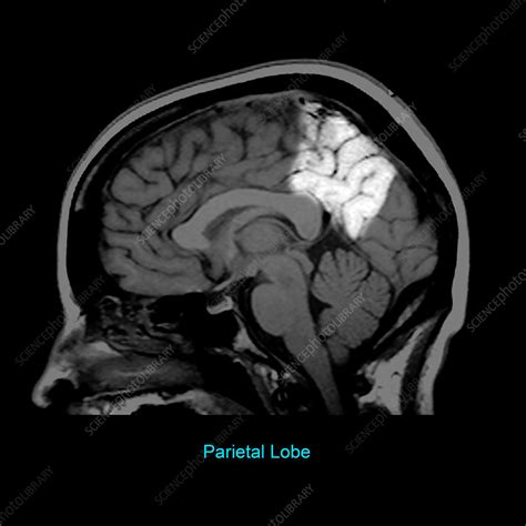 Parietal Lobe, Sagittal MRI - Stock Image - C030/6312 - Science Photo ...