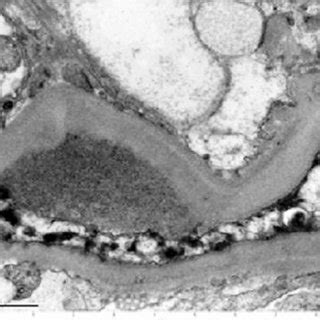 Electron microscope, magnification × 40000 (scale bar: 1 μ m ...