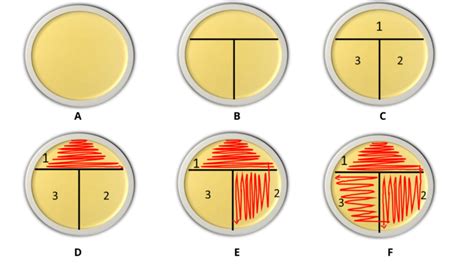 Streak Plate Method Principal And Types Rbr Life Science