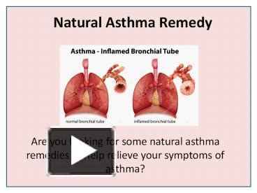 PPT Natural Treatments For Bronchial Asthma Asthma Bronchitis