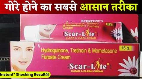 Scarlite Gel Uses In Hindi Instant Shocking Result It S Working