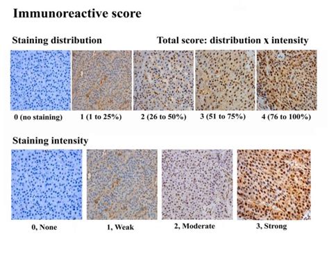 Typical Scored Immunohistochemical Staining Of Liver Tissue Specimens Download Scientific