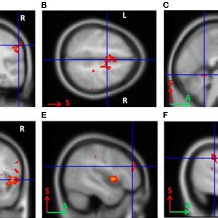 Areas Of Activation During Grasping Imagery In Untrained Subjects