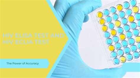 HIV ELISA Test And HIV ECLIA Test: The Power of Accuracy