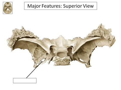 Sphenoid Bone Markings Flashcards Quizlet