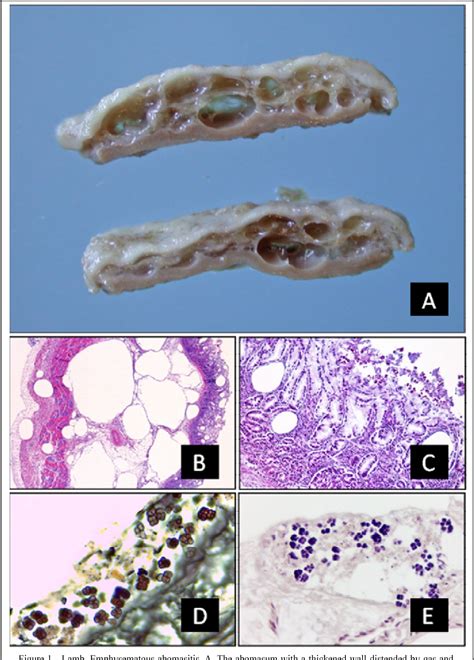 Figure From Emphysematous Abomasitis In A Lamb By Bacteria Of The