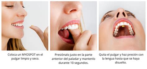 Consejos De Higiene Bucal La Postura De La Lengua Adecuada Blog