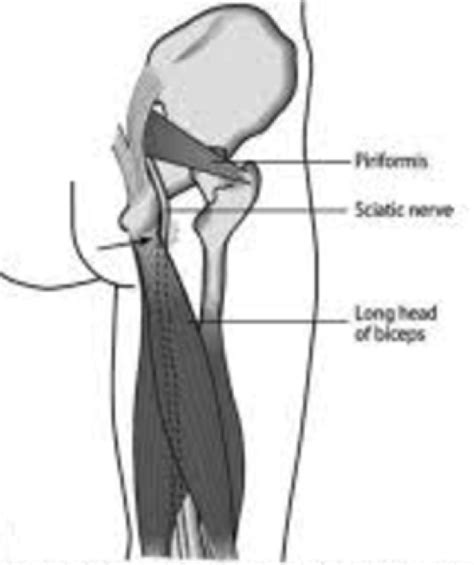 Hamstring Tendonitis (or is it Hamstring Syndrome?) | Zion Physical Therapy