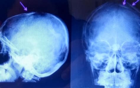 Um Paciente De 30 Anos De Idade Chegou Ao Departamento De Radiologia