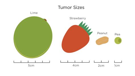 Stages Grades Of Breast Cancer My Breast Cancer Compass